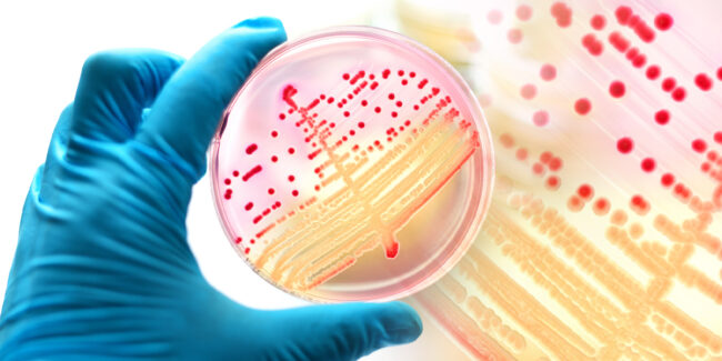 Les arthropodes domestiques sont des réservoirs de pathogènes humains opportunistes